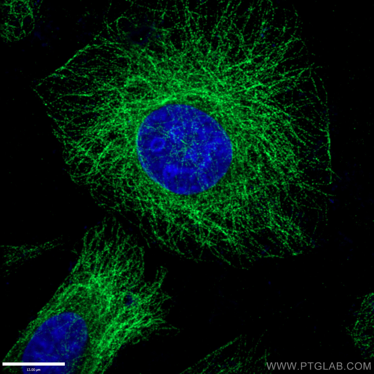 IF Staining of HepG2 using 66031-1-Ig (same clone as 66031-1-PBS)