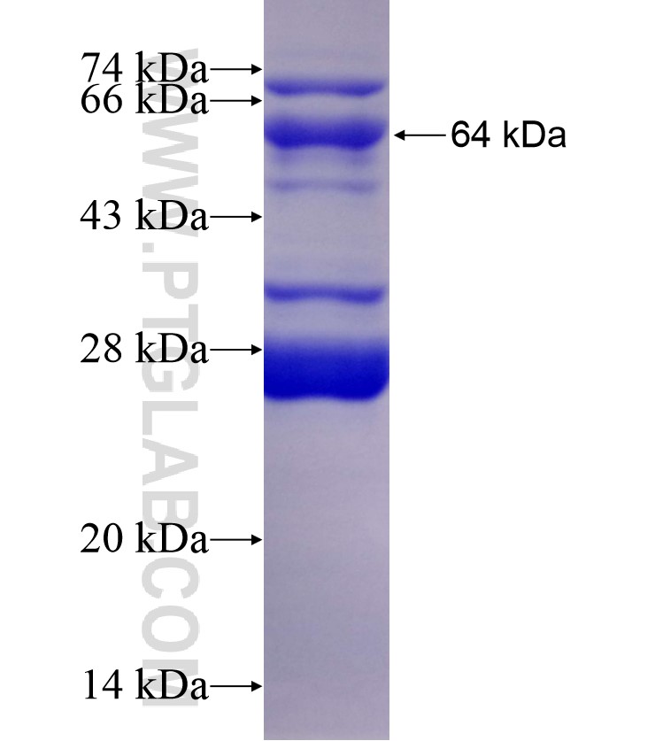 uPA fusion protein Ag11813 SDS-PAGE
