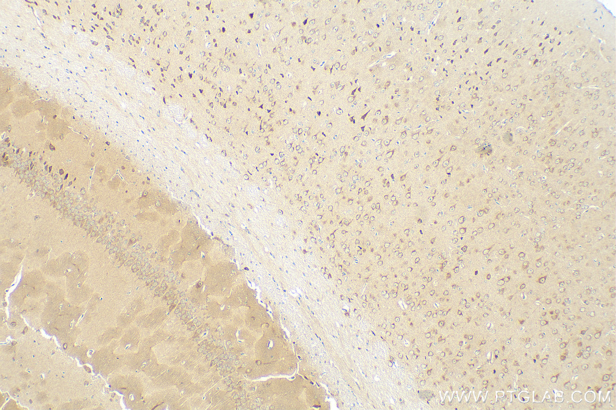 IHC staining of mouse brain using 82953-1-RR