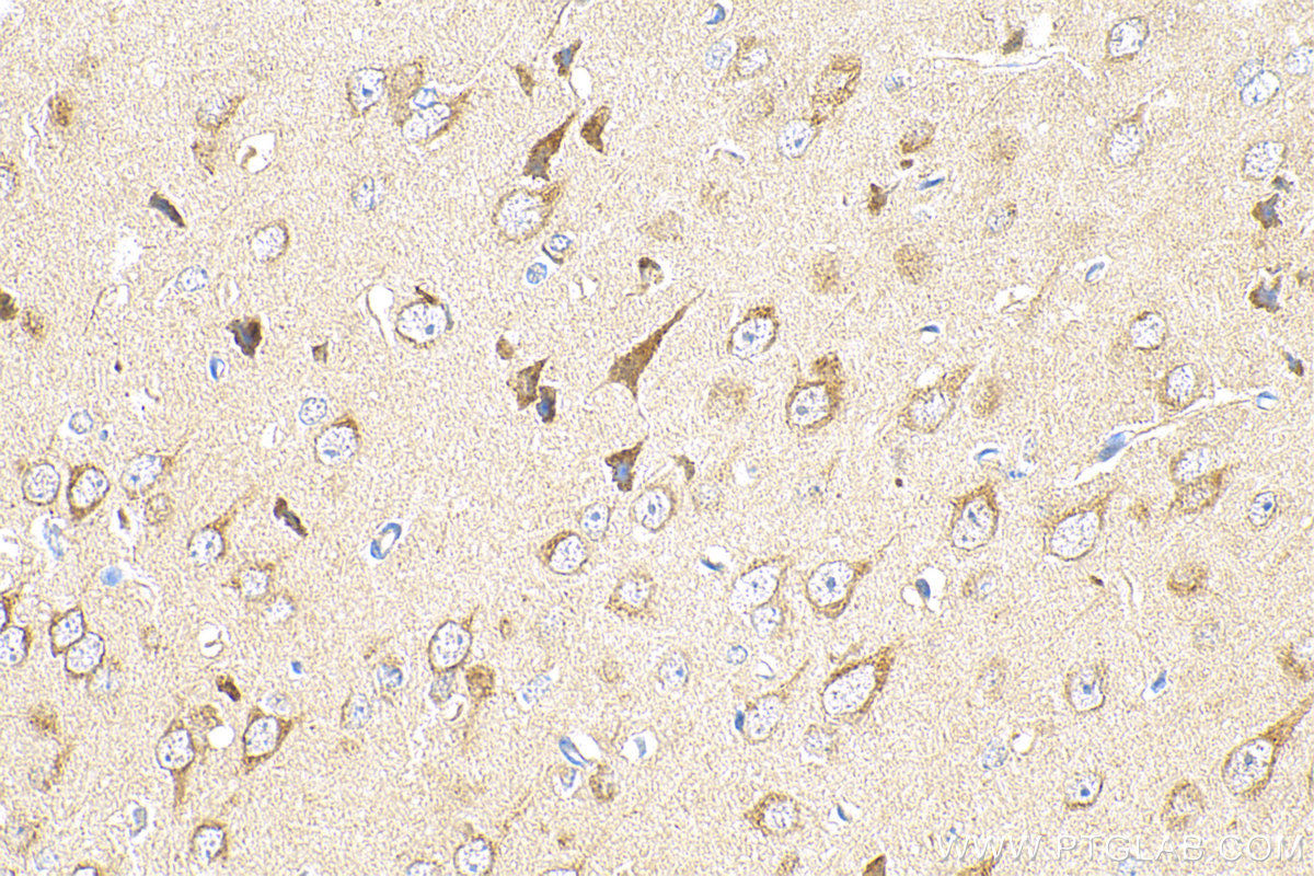 IHC staining of mouse brain using 82953-1-RR