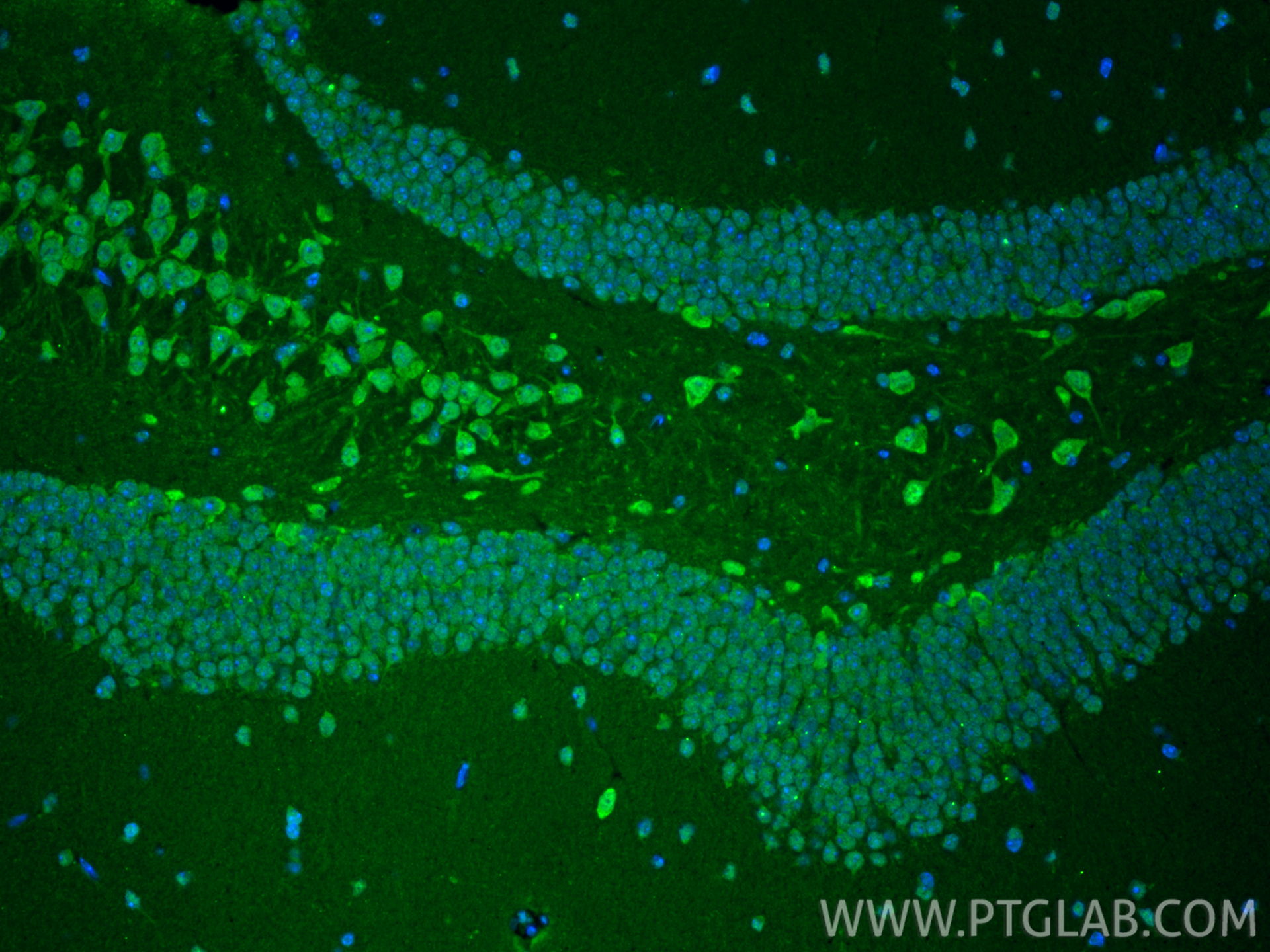 IF Staining of mouse brain using 10201-2-AP IF Staining of mouse brain using 10201-2-AP