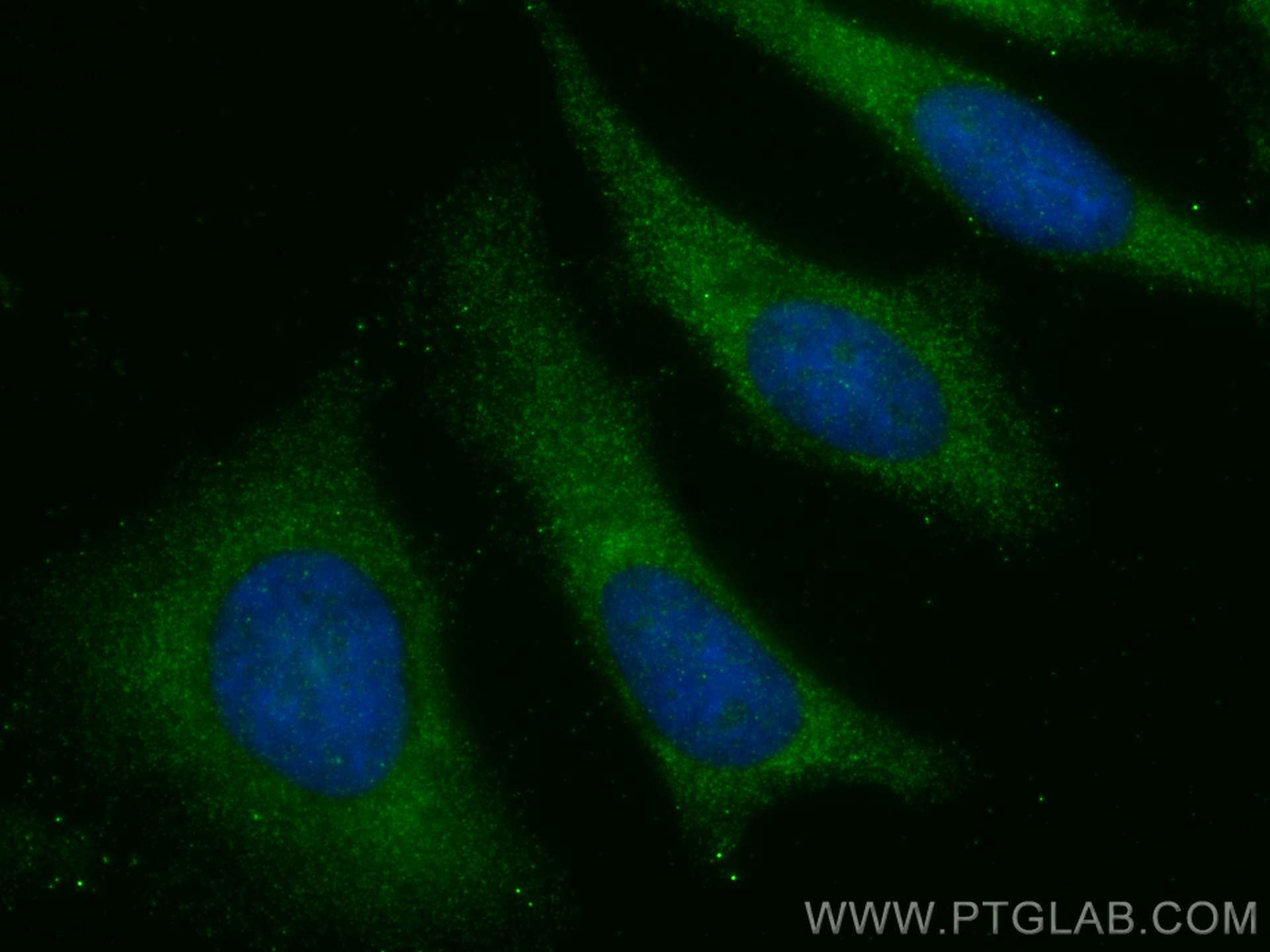 IF Staining of HeLa using 14946-1-AP