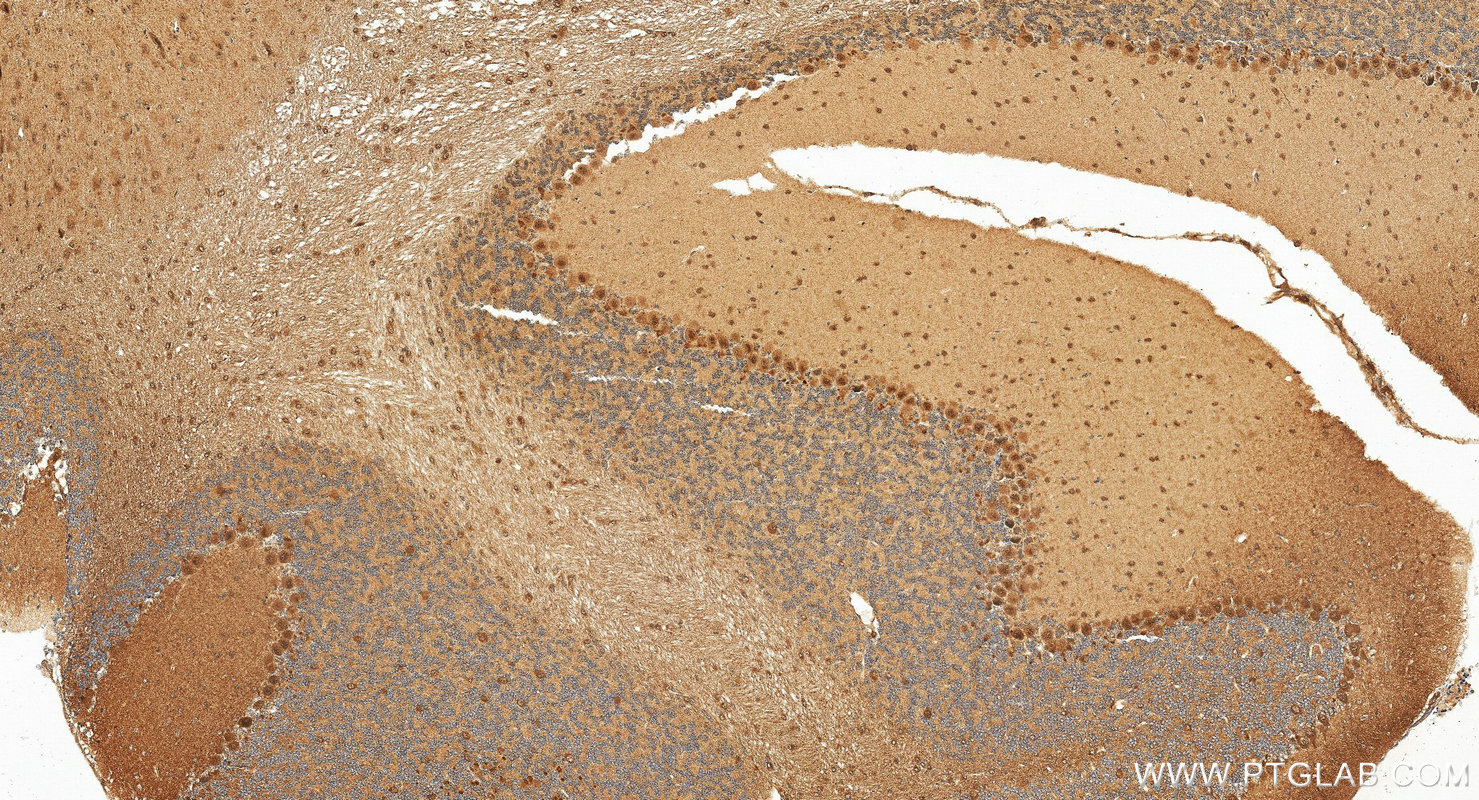 IHC staining of mouse cerebellum using 14946-1-AP IHC staining of mouse cerebellum using 14946-1-AP