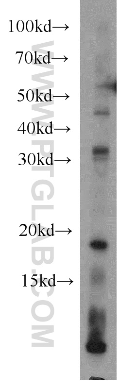 WB analysis of mouse cerebellum using 14946-1-AP