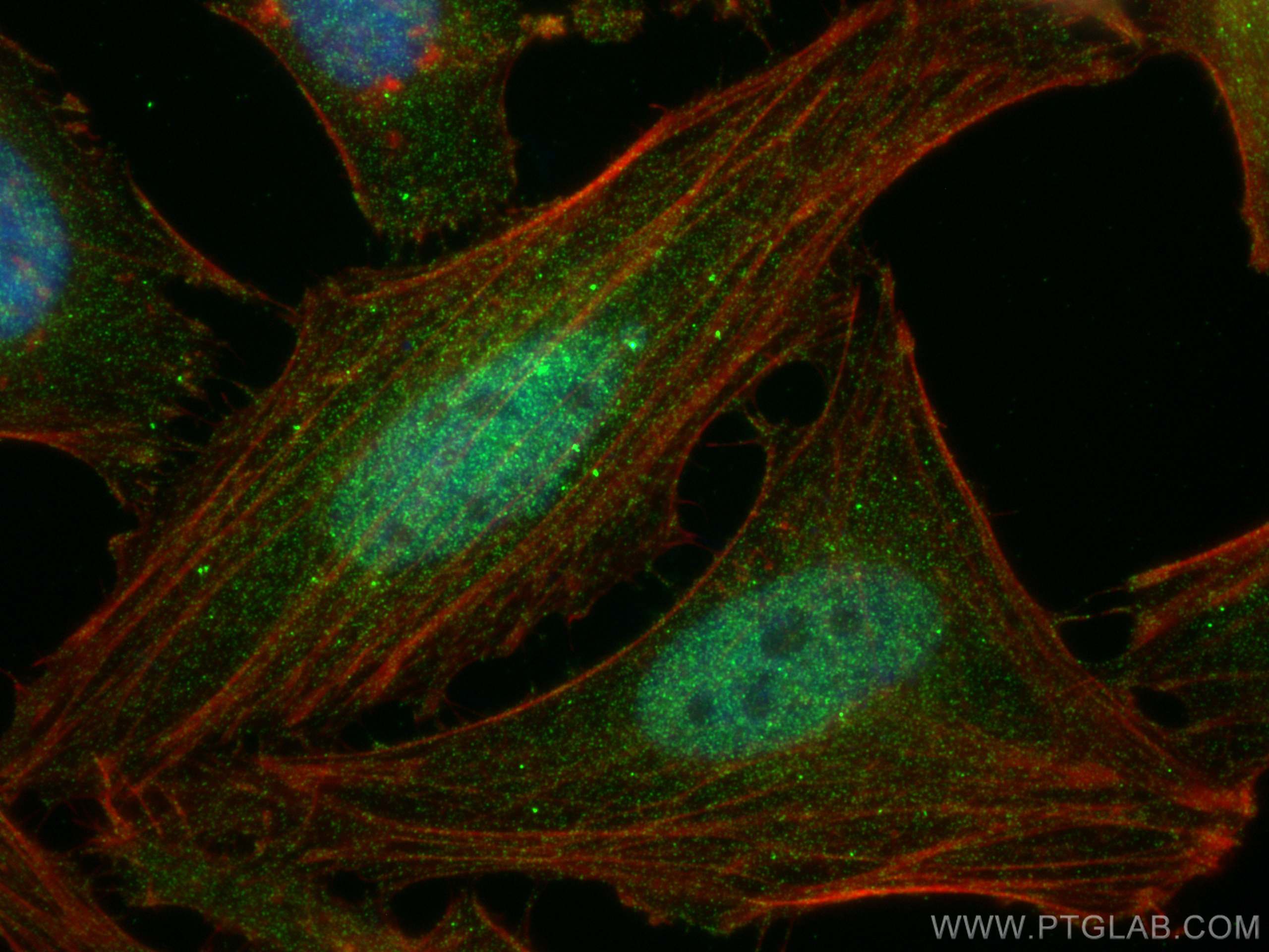 ubiquitin
