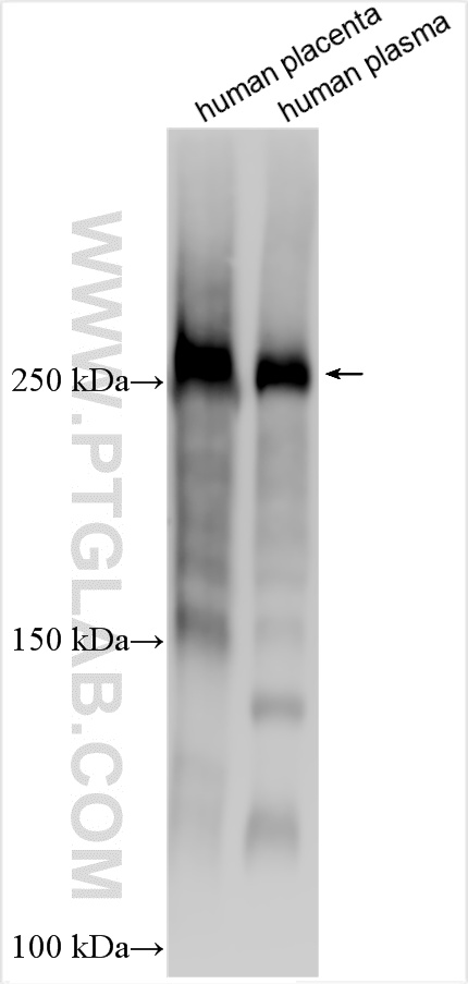 WB analysis using 27186-1-AP