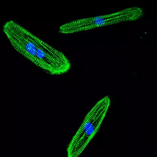 IF Staining of Human iPSC derived cardiomyocyte using ACTN2 antibody (14221-1-AP)