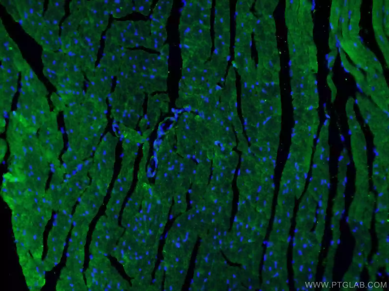 IF analysis of mouse heart tissue using Beclin 1 antibody (11306-1-AP) at a dilution of 1:50 and Alexa Fluor 488-Conjugated AffiniPure Goat Anti-Mouse IgG(H+L).