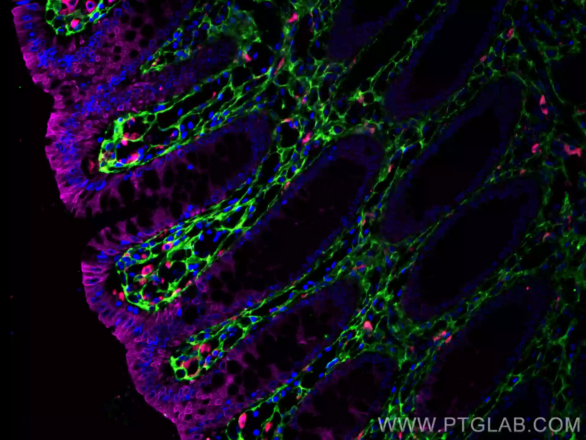 Immunofluorescent analysis of (4% PFA) fixed human colon tissue using CoraLite®594 CD68 antibody (CL594-25747) at dilution of 1:200, CoraLite®488 Cytokeratin 20 antibody (CL488-60183, Clone: 4D10A4, green), Collagen Type III (N-terminal) antibody (22734-1-AP, Magenta).