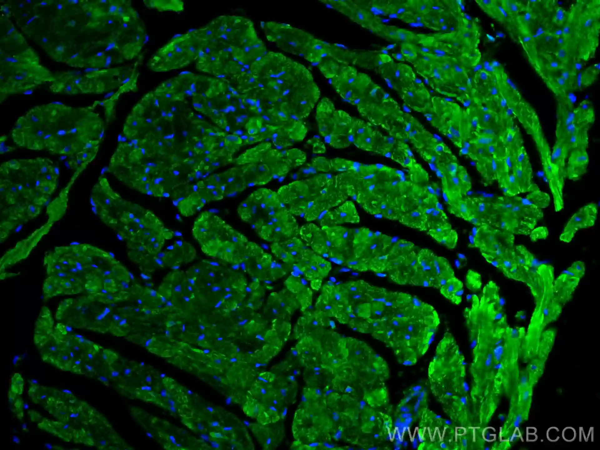 IF analysis of mouse heart tissue using PARK2/Parkin antibody (14060-1-AP) at a dilution of 1:200 and CoraLite®488-Conjugated AffiniPure Goat Anti-Rabbit IgG(H+L).